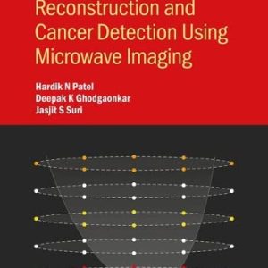 Breast Image Reconstruction and Cancer Detection Using Microwave Imaging (Original PDF from Publisher)