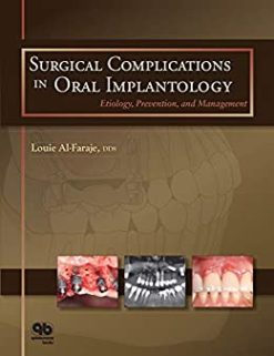 Surgical Complications in Oral Implantology: Etiology, Prevention, and Management (Original PDF from Publisher)