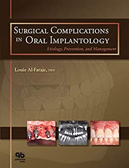 Surgical Complications in Oral Implantology: Etiology, Prevention, and Management (Original PDF from Publisher)