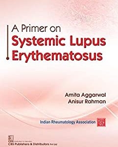 A Primer on Lupus Systematic Erythematosus (Original PDF from Publisher)