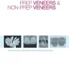 Prep Veneers und Non-Prep Veneers: Keramische minimalinvasive Restaurationen (German Edition) (EPUB)