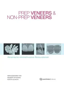 Prep Veneers und Non-Prep Veneers: Keramische minimalinvasive Restaurationen (German Edition) (EPUB)