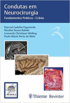 Condutas em Neurocirurgia: Fundamentos Práticos – Crânio (EPUB)