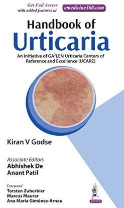 Handbook of Urticaria (Original PDF from Publisher)