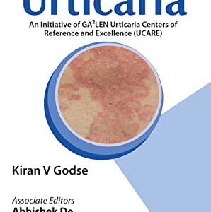 Handbook of Urticaria (Original PDF from Publisher)