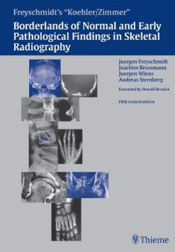 Koehler/Zimmer’s Borderlands of Normal and Early Pathological Findings in Skeletal Radiography, 5th edition (Original PDF from Publisher)
