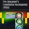 Pre-Descemet’s Endothelial Keratoplasty (PDEK) (Original PDF from Publisher+Videos)