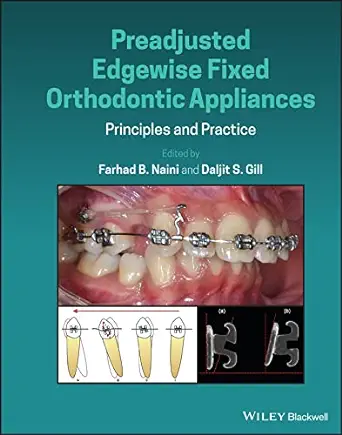 Preadjusted Edgewise Fixed Orthodontic Appliances: Principles and Practice (EPUB)