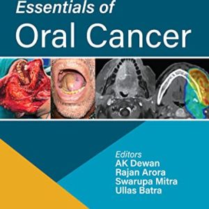 Essentials of Oral Cancer (Original PDF from Publisher)