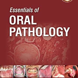 Essentials of Oral Pathology, 4th Edition (Original PDF from Publisher)