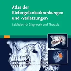Atlas der Kiefergelenkerkrankungen und -verletzungen: Leitfaden zur Diagnostik und Therapie (German Edition) (True PDF from Publisher)