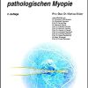 Diagnose und Therapie der pathologischen Myopie (UNI-MED Science) (German Edition), 2nd Edition (Original PDF from Publisher)
