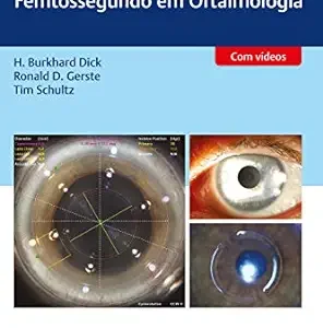 Cirurgia a Laser de Femtossegundo em Oftalmologia (Portuguese Edition) (Original PDF from Publisher)