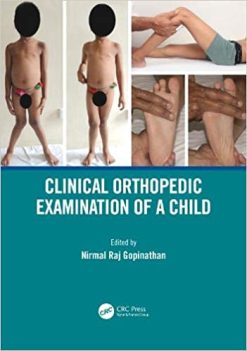 Clinical Orthopedic Examination of a Child (Original PDF from Publisher)