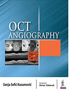 OCT Angiography (Original PDF from Publisher)