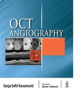 OCT Angiography (Original PDF from Publisher)