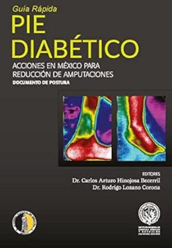Pie Diabético – Guía Rápida (Spanish Edition) (EPUB)