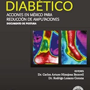 Pie Diabético – Guía Rápida (Spanish Edition) (EPUB)