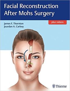 Facial Reconstruction After Mohs Surgery (EPUB)