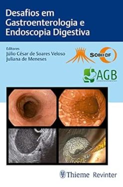Desafios em Gastroenterologia e Endoscopia Digestiva (Portuguese Edition) (EPUB)
