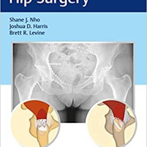 Synopsis of Hip Surgery (ORIGINAL PDF from Publisher)