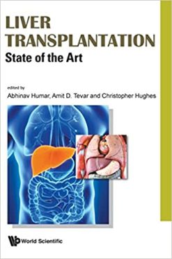 Liver Transplantation: State of the Art (Original PDF from Publisher)