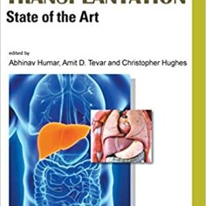 Liver Transplantation: State of the Art (Original PDF from Publisher)