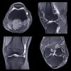 NYU Langone Advanced Imaging of the Musculoskeletal System: Up Your Game 2023 (Videos)