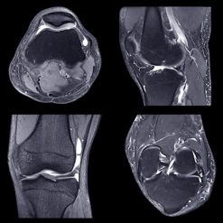 NYU Langone Advanced Imaging of the Musculoskeletal System: Up Your Game 2023 (Videos)