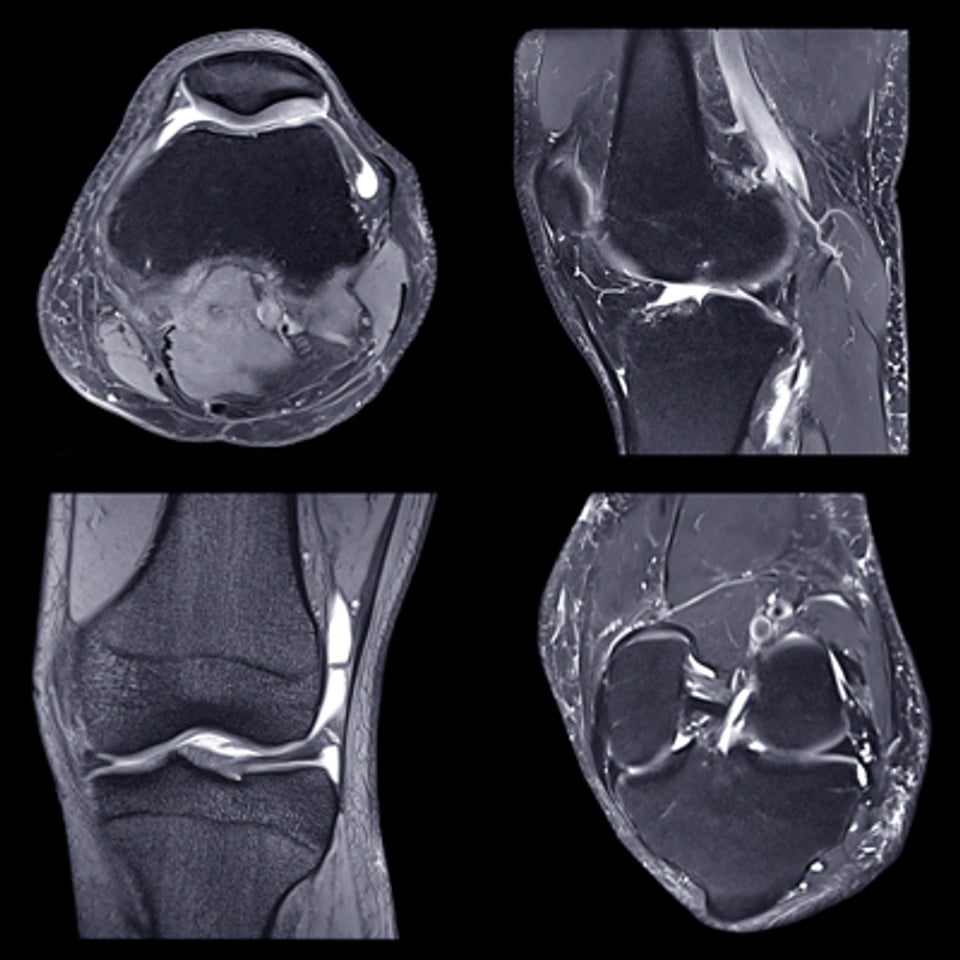 NYU Langone Advanced Imaging of the Musculoskeletal System: Up Your Game 2023 (Videos)