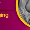 Knee Imaging Essentials 2022 (Videos)