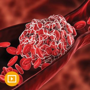 Thrombosis & Thromboembolism 2022 (Videos)