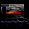 Society for Vascular Medicine Comprehensive Review of Vascular Ultrasound Interpretation and Registry Preparation 2023 (Videos)