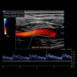 Society for Vascular Medicine Comprehensive Review of Vascular Ultrasound Interpretation and Registry Preparation 2023 (Videos)