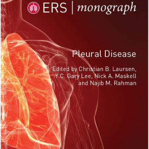 ERS Monograph 87: Pleural Disease (ORIGINAL PDF from Publisher)