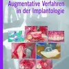 Augmentative Verfahren in der Implantologie (German Edition) (EPUB)
