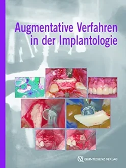 Augmentative Verfahren in der Implantologie (German Edition) (EPUB)