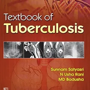 Textbook of Tuberculosis (Original PDF from Publisher)