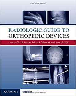 Radiologic Guide to Orthopedic Devices, 1e (ORIGINAL PDF from Publisher)