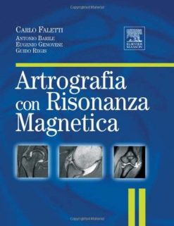 Artrografia con risonanza magnetica (EPUB2 + Converted PDF)