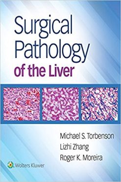 Surgical Pathology of the Liver (EPUB)