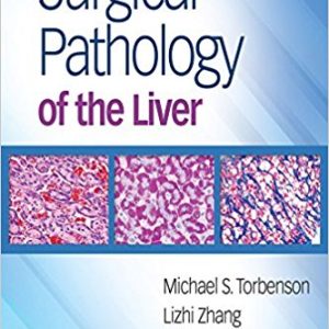 Surgical Pathology of the Liver (EPUB)