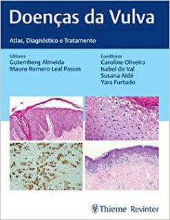Doenças da Vulva: Atlas, Diagnóstico e Tratamento (EPUB)