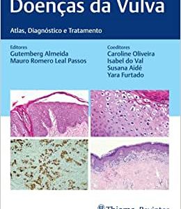 Doenças da Vulva: Atlas, Diagnóstico e Tratamento (EPUB)
