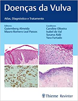 Doenças da Vulva: Atlas, Diagnóstico e Tratamento (EPUB)