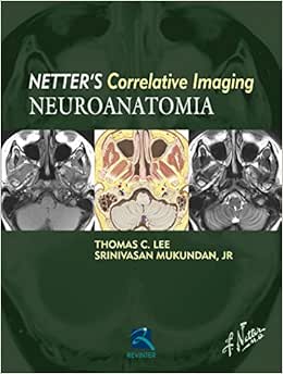 Neuroanatomia: Netter’s Currelative Imaging, 1st Edition (Original PDF from Publisher)