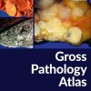 Gross Pathology Atlas: A Guide to Gross Specimens Evaluation (Original PDF from Publisher)