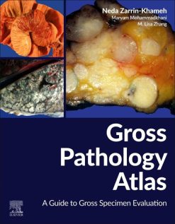 Gross Pathology Atlas: A Guide to Gross Specimens Evaluation (Original PDF from Publisher)