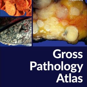 Gross Pathology Atlas: A Guide to Gross Specimens Evaluation (Original PDF from Publisher)