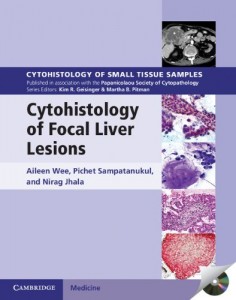 Cytohistology of Focal Liver Lesions (Original PDF from Publisher)
